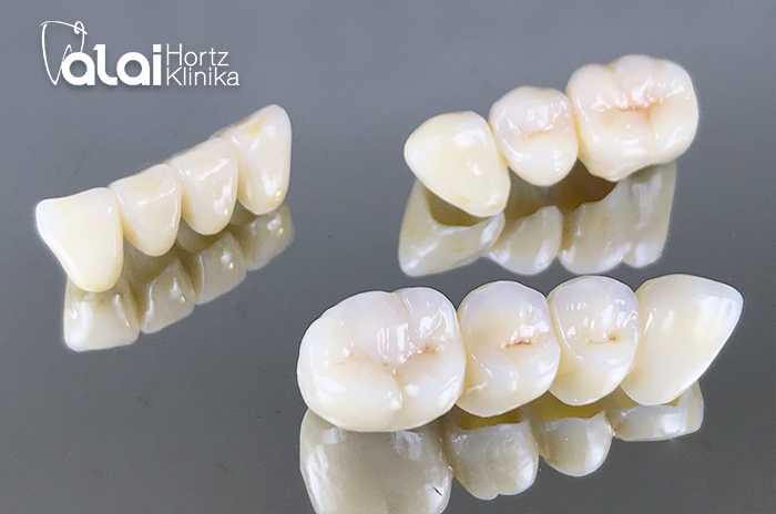 Stomatek Salud dental. - ¿Qué son los dientes postizos de Zirconio?🦷 Las  prótesis dentales, también conocidas como Dientes Postizos sirven para  restablecer la estética, para la pronunciación y para la masticación tras